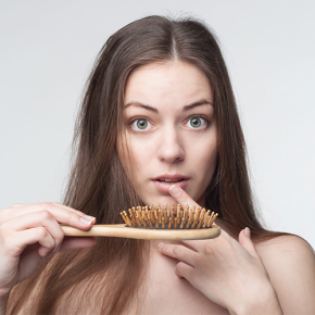 alopecia